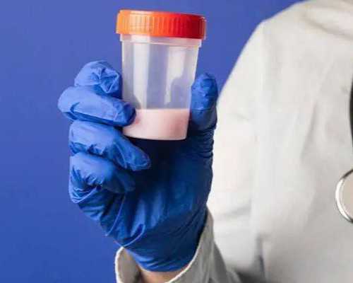 国内代生专业机构,精子正常形态为0做试管可以吗，简述男性精子畸形的调理方法