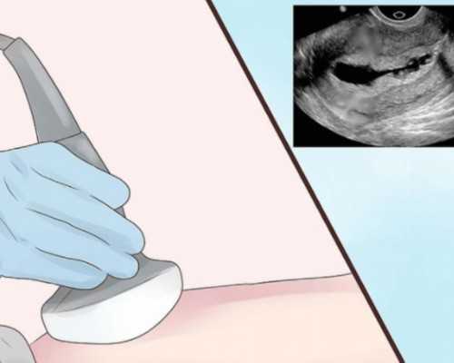 国内可靠的供卵医院,孕妇感冒伴发热该怎么办？