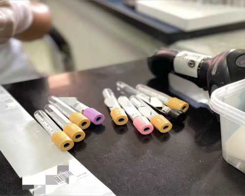 国内代生哪家好,男性精液常规检查中这10个项目必不可少