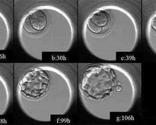 中国捐卵,“揭秘2026最新兰州供卵不排队医院，谁才是真正的‘试管婴儿之都’？”