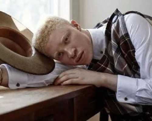 国内代孕最好的中心,做试管羊穿了该怎么办呢？究竟严重吗？